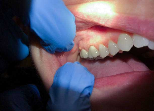Best Broken Tooth Emergency  in Paden City, WV